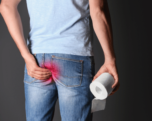 Pilonidal Sinus Treatment